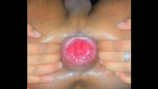 Stretched Wide Then Fucked Raw: Extreme Anal Opening – GayFetish 18+